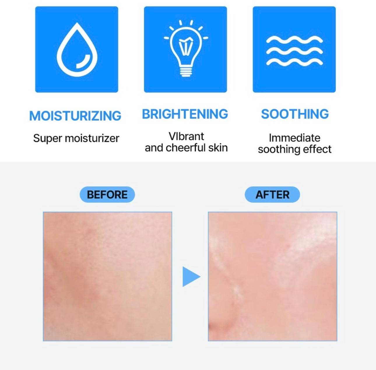 SD-Control Hyaluronic Acid